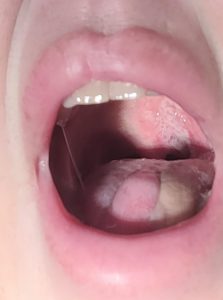 Sharon Moreby's tongue